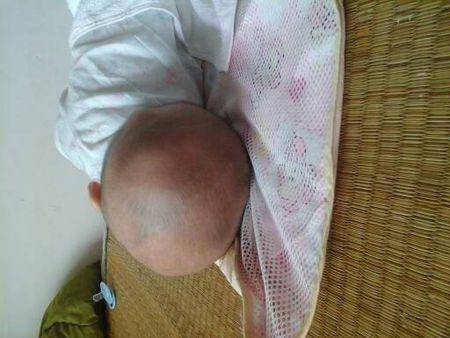小孩不小心摔到后脑勺有什么后果小孩不小心摔到后脑勺，后果与应对措施