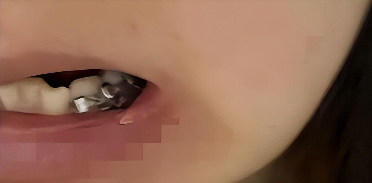 男子疑女友出轨拔掉其8颗牙后又杀人